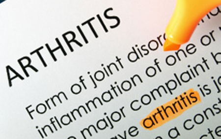 Information on the Management of Arthritis